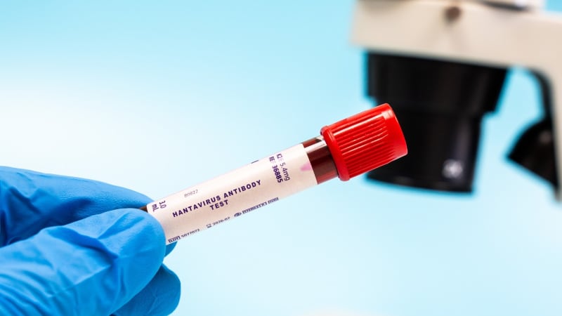 Smrtící hantavirus v Curychu: Nakaženým je švýcarský pasažér z výletní lodi 