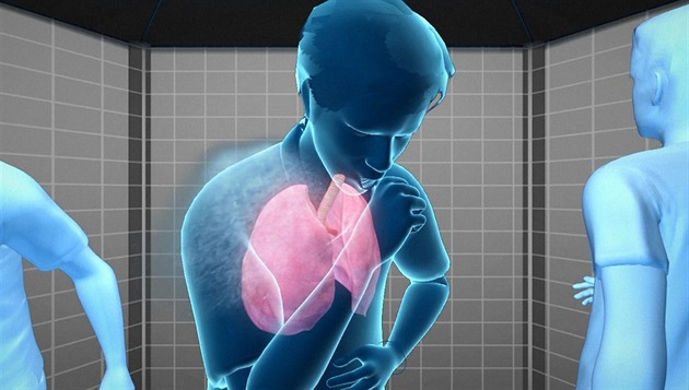 Plicní mor: jaké jsou příznaky, jak se šíří a proč je nejnebezpečnější formou nemoci